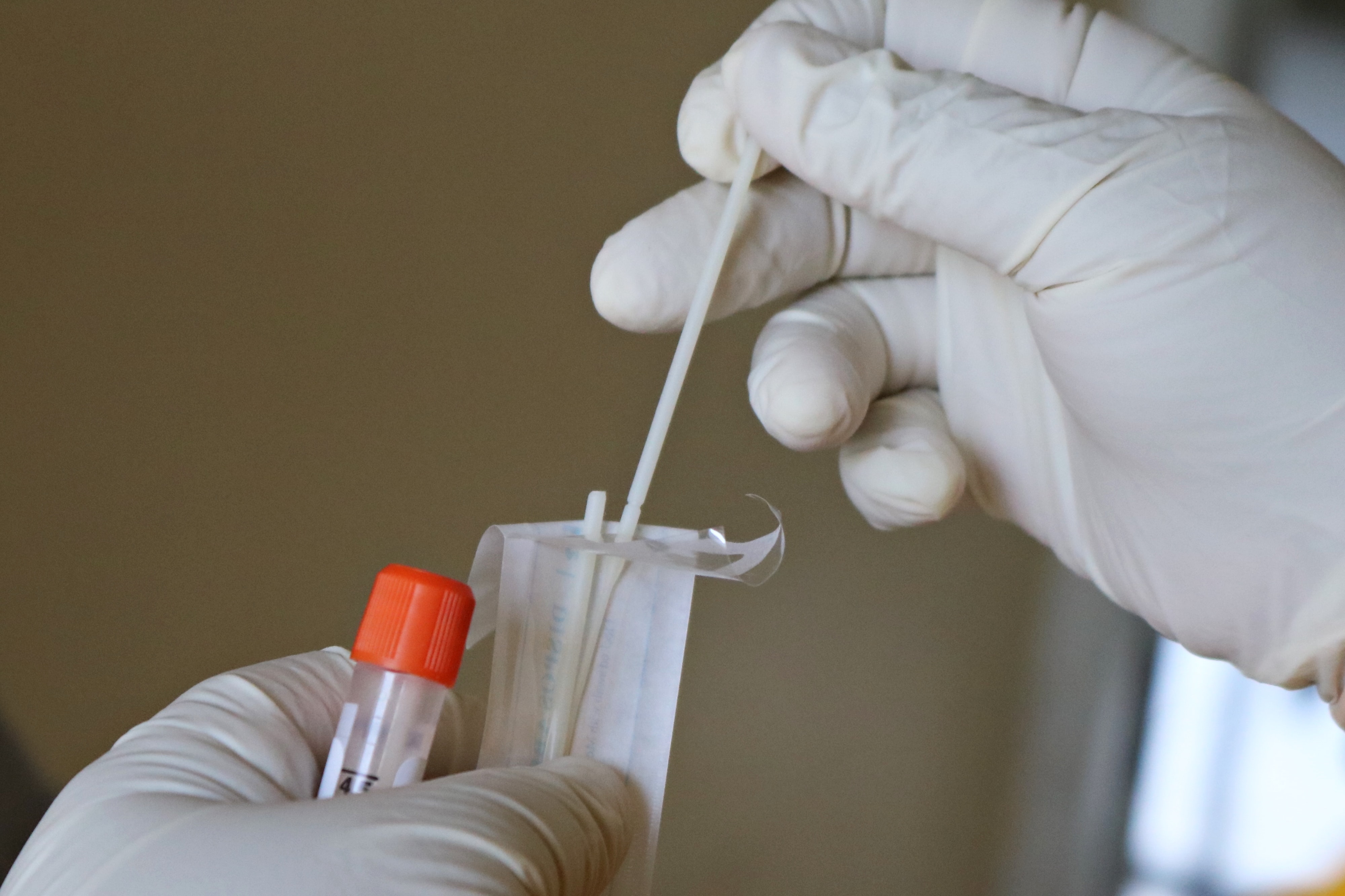 Tamponi veloci, il modulo e tutte le info Tutto pronto per lo screening Covid-19 previsto a Pesaro dal 18 al 23 dicembre 2020 nell’intero territorio comunale.